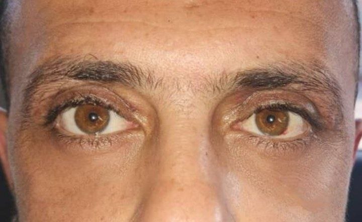 بعد